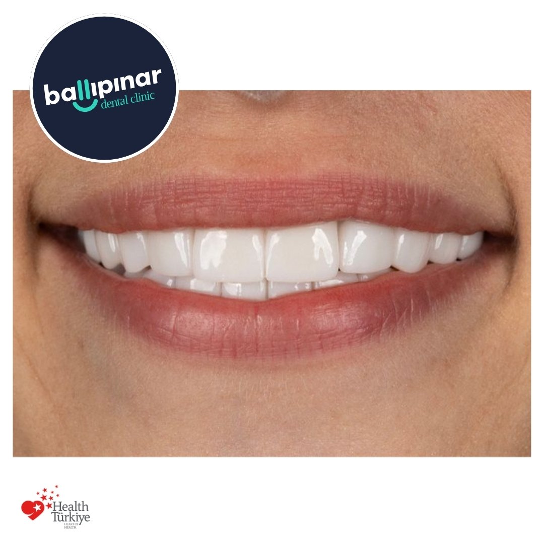 Cosmetic Dentistry Treatments
