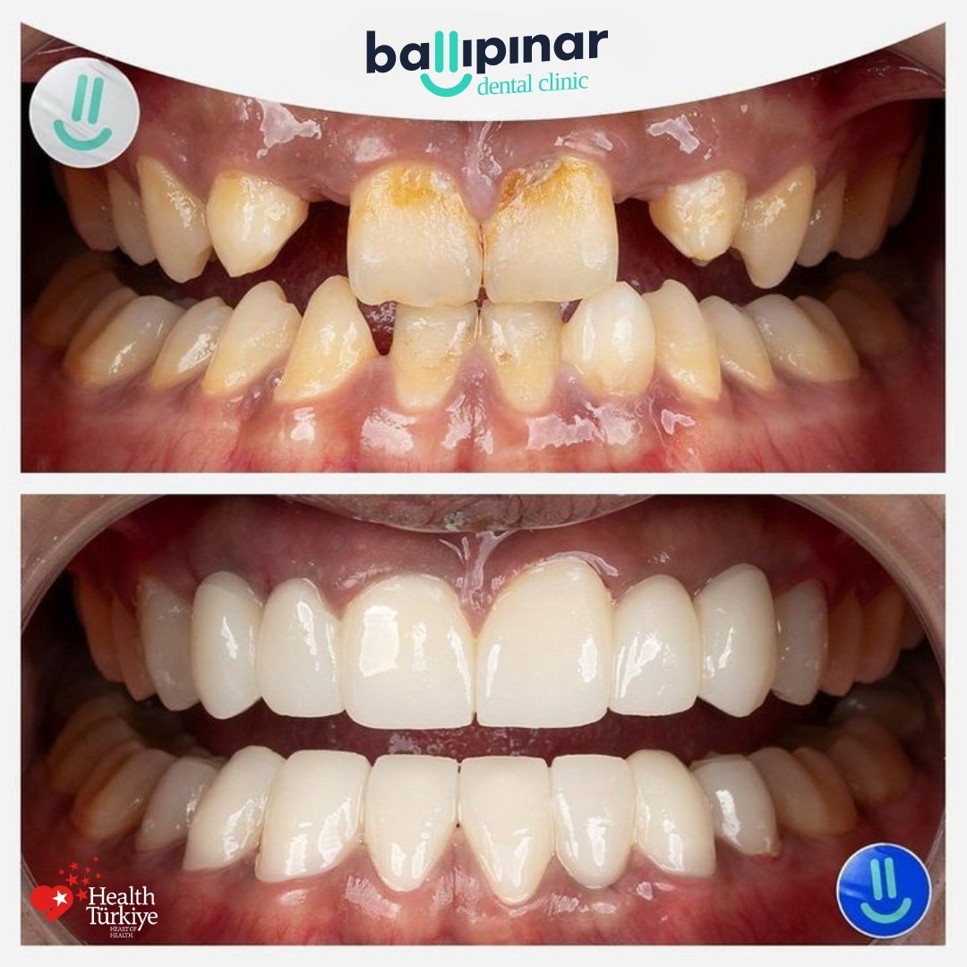 treatment-content-image-1