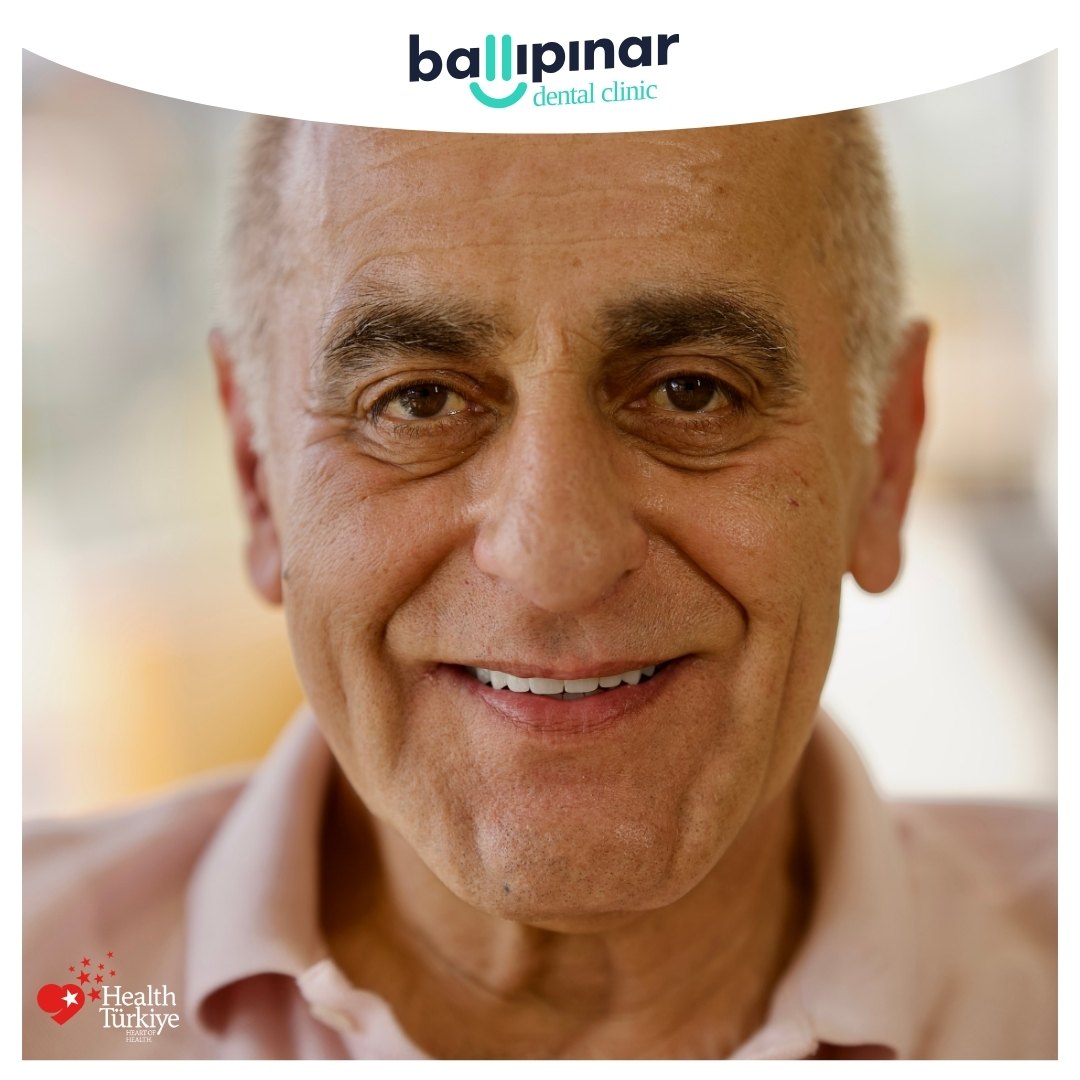 All on 6 Dental Implants: Your Gateway to a Perfect Smile