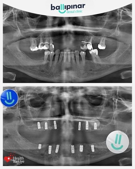 treatment-content-image-1