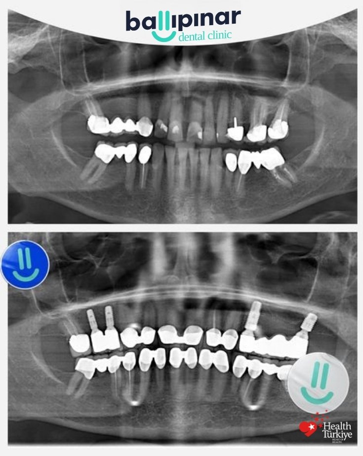 treatment-content-image-1