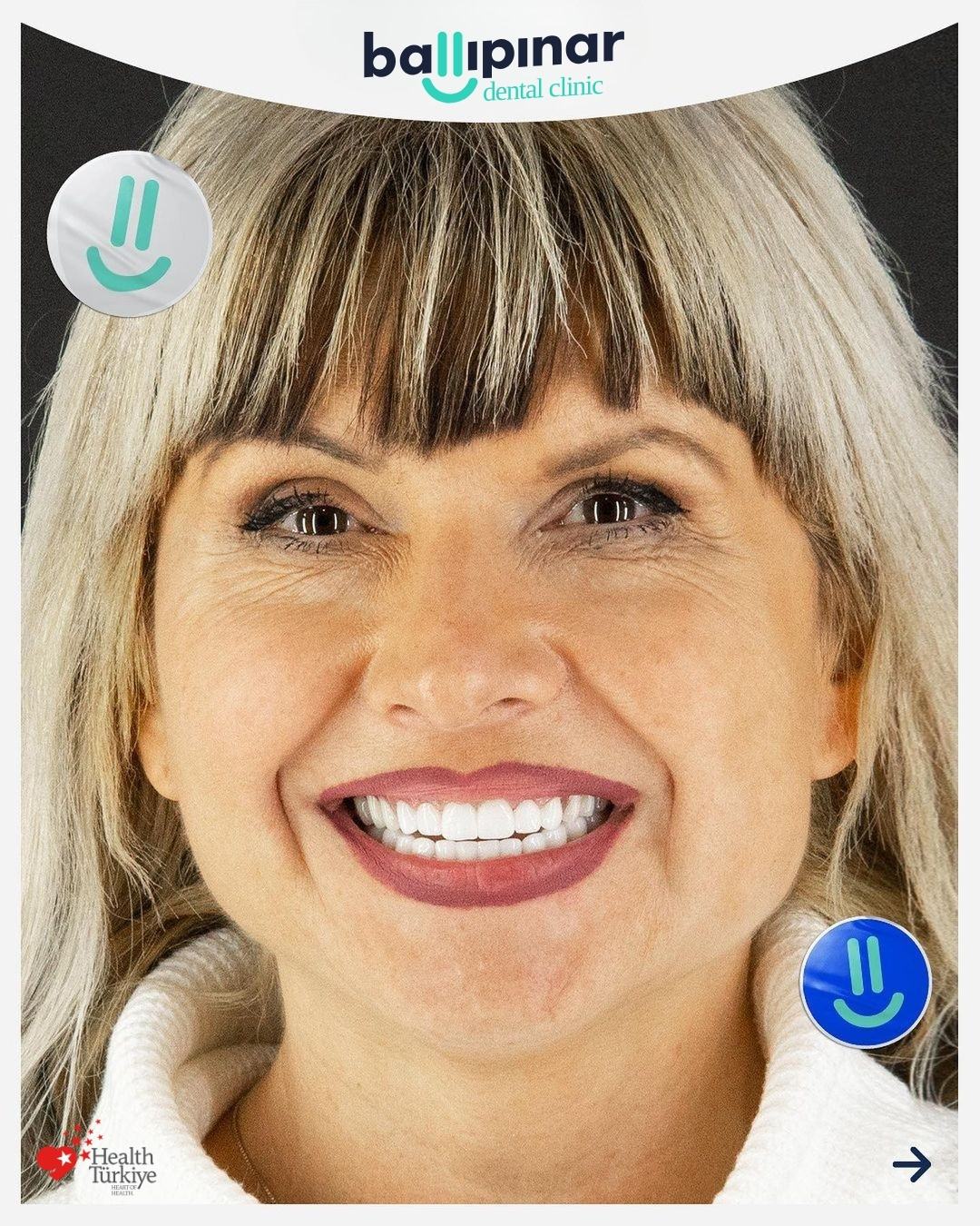 Overdenture