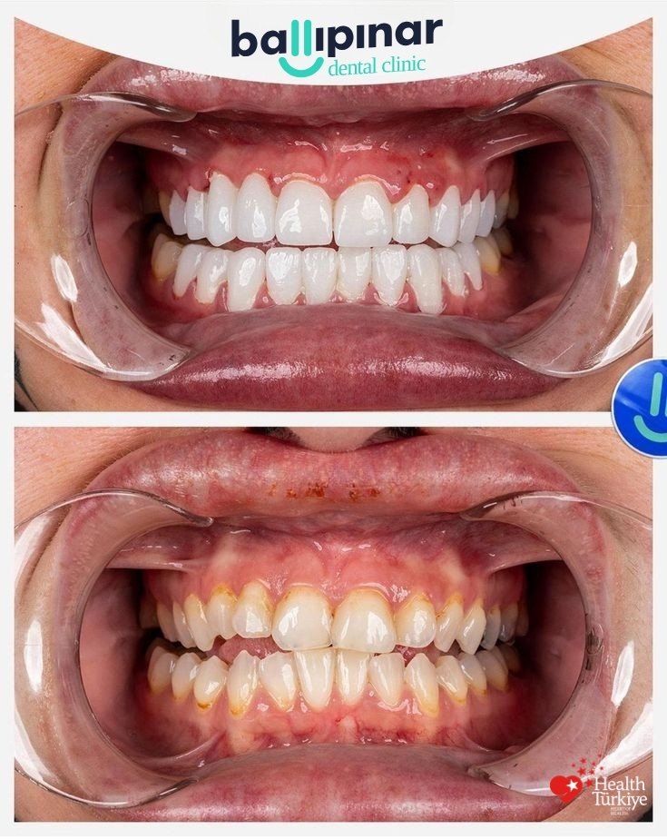 treatment-content-image-2