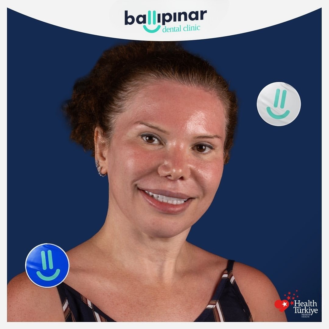 treatment-content-image-1